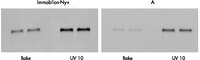 Mouse liver total RNA (1 µg) was resolved on a formaldehyde agarose gel and transferred to Immobilon-Ny+ and a competitor's positively charged nylon membrane 